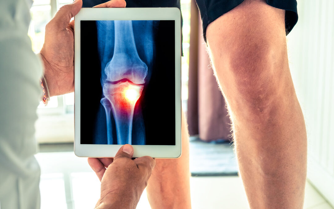 What Does an Arthrogram Do for Joint Pain?