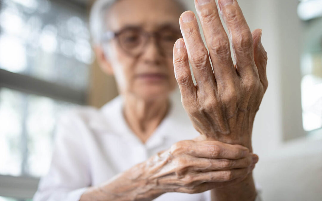 Managing & Treating the Pain of Rheumatoid Arthritis