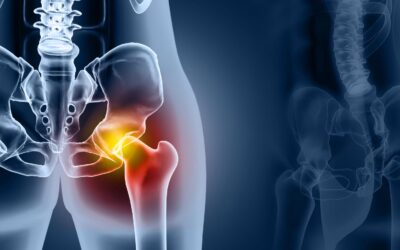 Understanding Sacroiliac Joint Injections: A Safe and Effective Pain Management Solution