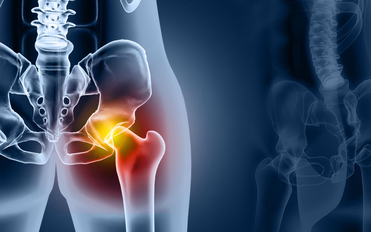 Understanding Sacroiliac Joint Injections: A Safe and Effective Pain ...